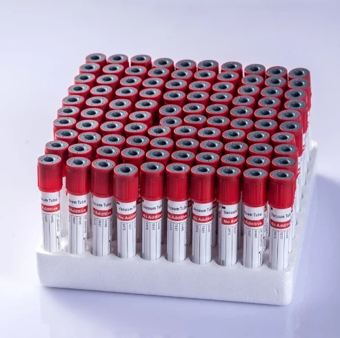 Red Top Blood Collection Tube (No Additive/Plain) For Serum & Clotting Tests best