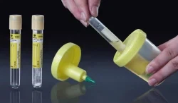 Vacuum Urine Specimen Cups 20ml-150ml